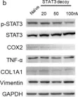 Fig.2.B showing Western Blotting from the publication: STAT3 Decoy Oligodeoxynucleotides Suppress Liver Inflammation and Fibrosis in Liver Cancer Cells and a DDC-Induced Liver Injury Mouse Model.