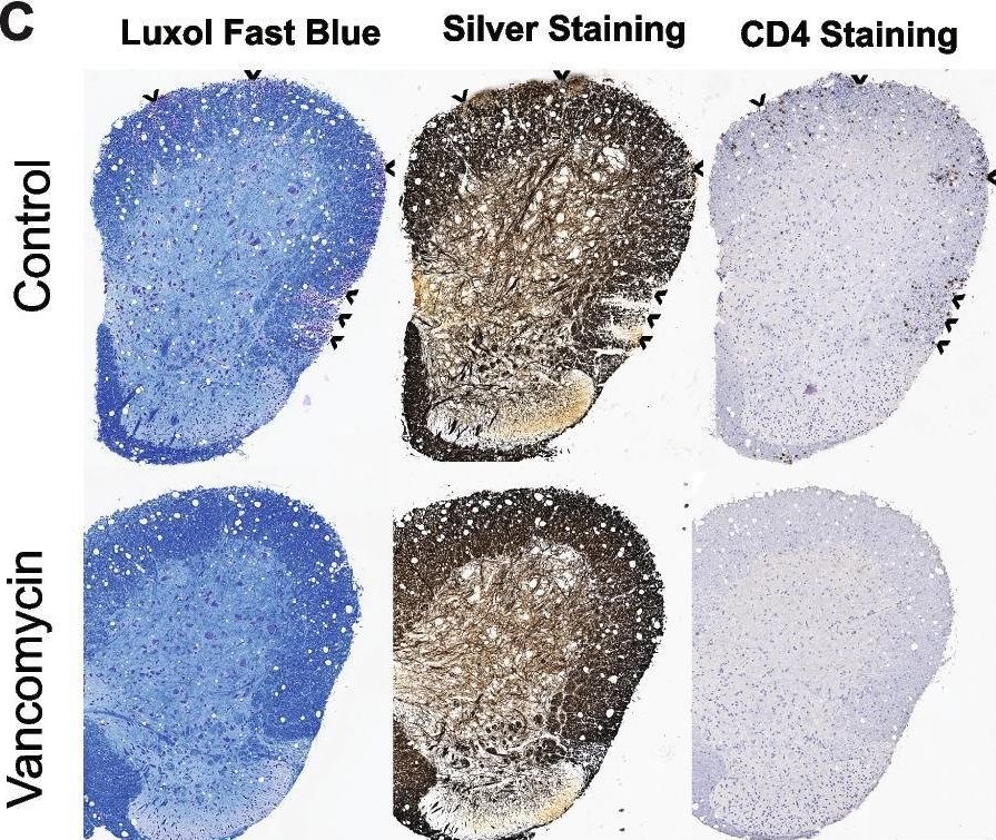 Fig.2.C showing Immunohistochemistry in a Mus musculus (House mouse) sample from the publication: Mining the microbiota to identify gut commensals modulating neuroinflammation in a mouse model of multiple sclerosis.