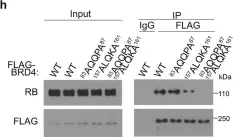 Fig.3.H showing Western Blotting from the publication: Retinoblastoma protein as an intrinsic BRD4 inhibitor modulates small molecule BET inhibitor sensitivity in cancer.