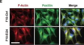 Fig.1.E showing Immunocytochemistry-immunofluorescence from the publication: EI24 regulates epithelial-to-mesenchymal transition and tumor progression by suppressing TRAF2-mediated NF-κB activity.