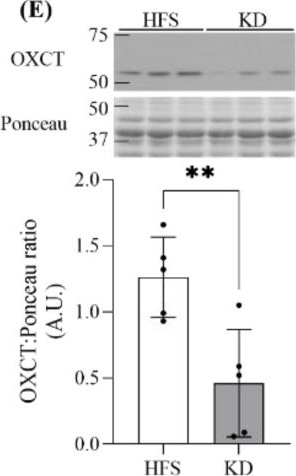 Fig.3.E showing Western Blotting from the publication: Sucrose-Enriched and Carbohydrate-Free High-Fat Diets Distinctly Affect Substrate Metabolism in Oxidative and Glycolytic Muscles of Rats.