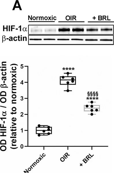 Fig.2.A showing Western Blotting from the publication: Novel insights into β3-adrenoceptor function in a model of retinopathy of prematurity: the contribution of astrocytes to retinal protection.