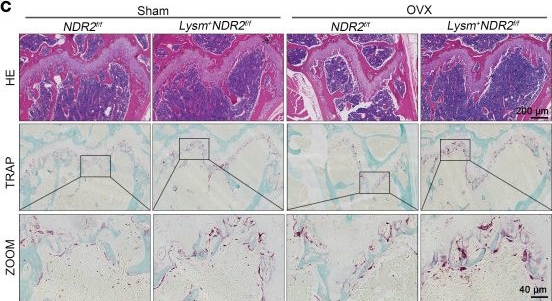 Fig.3.C showing Immunohistochemistry in a Mus musculus (House mouse) sample from the publication: NDR2 is critical for osteoclastogenesis by regulating ULK1-mediated mitophagy.