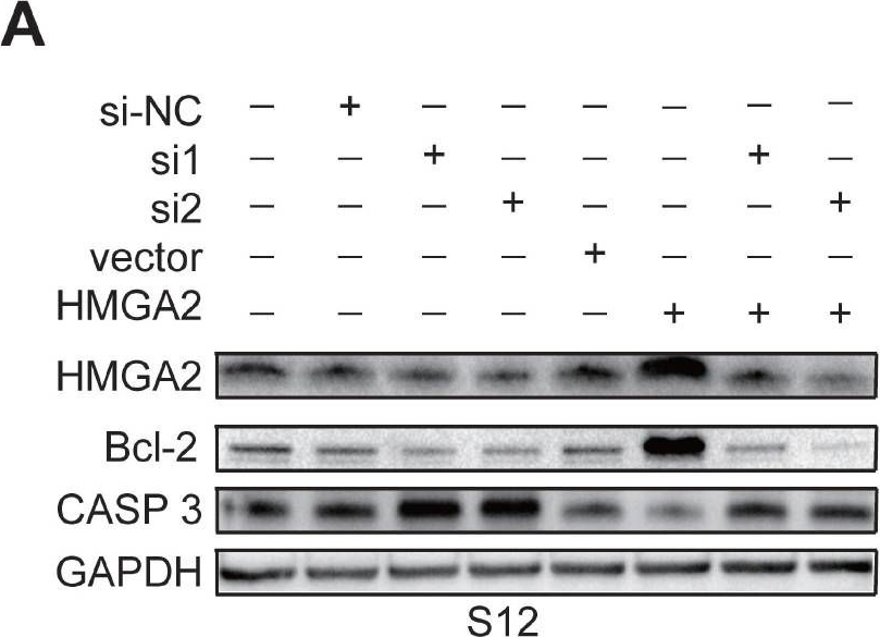 Fig.5.A showing Western Blotting in a Homo sapiens (Human) sample from the publication: Increased high mobility group A 2 expression promotes transition of cervical intraepithelial neoplasm into cervical cancer.