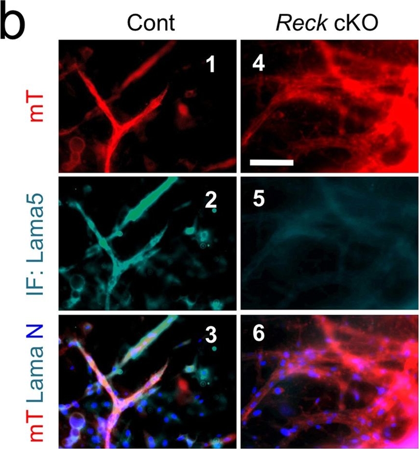 Critical roles for murine Reck in the regulation of vascular patterning and stabilization.
