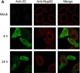 Fig.2.A showing Immunocytochemistry-immunofluorescence from the publication: Rhinovirus 3C protease facilitates specific nucleoporin cleavage and mislocalisation of nuclear proteins in infected host cells.