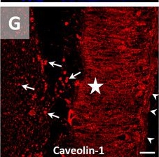 Fig.4.G showing Immunohistochemistry-immunofluorescence from the publication: The Oxytocin Receptor in Spermatozoa May Originate From Both Spermatogenesis and Epididymal Maturation, and Regulates Capacitation.