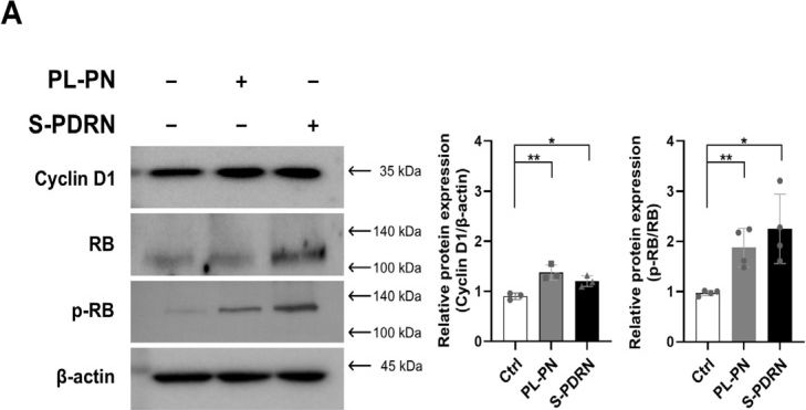 Fig.3.A showing Western Blotting in a Homo sapiens (Human) sample from the publication: Paeonia lactiflora Callus-Derived Polynucleotides Enhance Collagen Accumulation in Human Dermal Fibroblasts.