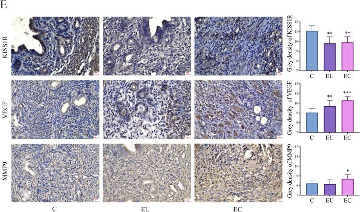 Fig.2.E showing Immunohistochemistry in a Mus musculus (House mouse) sample from the publication: Kisspeptins inhibit ectopic endometrial cell invasion and angiogenesis by suppressing PI3K/AKT signaling pathway via CREB5 in endometriosis.