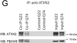 Fig.1.G showing Western Blotting in a Homo sapiens (Human) sample from the publication: Both ubiquitin ligases FBXW8 and PARK2 are sequestrated into insolubility by ATXN2 PolyQ expansions, but only FBXW8 expression is dysregulated.