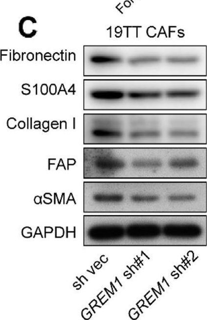 Fig.5.C showing Western Blotting from the publication: Cancer-associated fibroblast-derived Gremlin 1 promotes breast cancer progression.