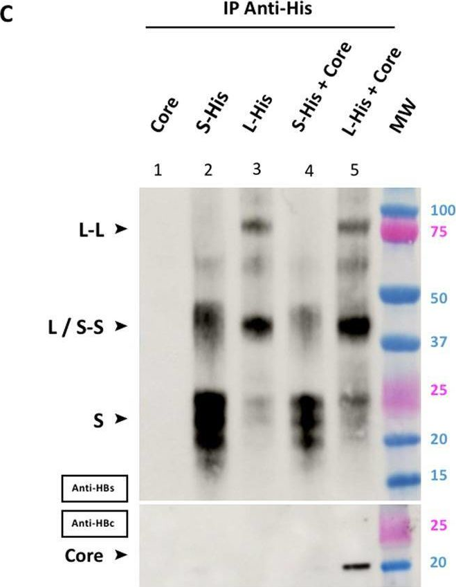 Fig.3.C showing Western Blotting from the publication: Direct interaction between the hepatitis B virus core and envelope proteins analyzed in a cellular context.
