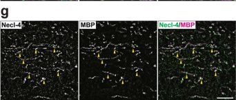 Fig.2.G showing Immunohistochemistry-immunofluorescence in a Mus musculus (House mouse) sample from the publication: Necl-4/CADM4 regulates GABAergic synaptic strength on GABAergic inhibitory neurons via ErbB4 activation and prevents neuronal impairments.