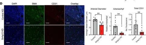Fig.6.D showing Immunohistochemistry-immunofluorescence in a Mus musculus (House mouse) sample from the publication: Deficiency of lncRNA SNHG12 impairs ischemic limb neovascularization by altering an endothelial cell cycle pathway.
