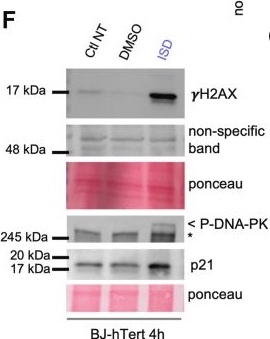 Fig.1.F showing Western Blotting in a Homo sapiens (Human) sample from the publication: Interferon stimulatory DNA activates the DNA damage signaling through ATM and DNA-PK sensing.