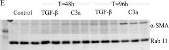 Fig.3.E showing Western Blotting in a Mus musculus (House mouse) sample from the publication: Macrophage to myofibroblast transition contributes to subretinal fibrosis secondary to neovascular age-related macular degeneration.