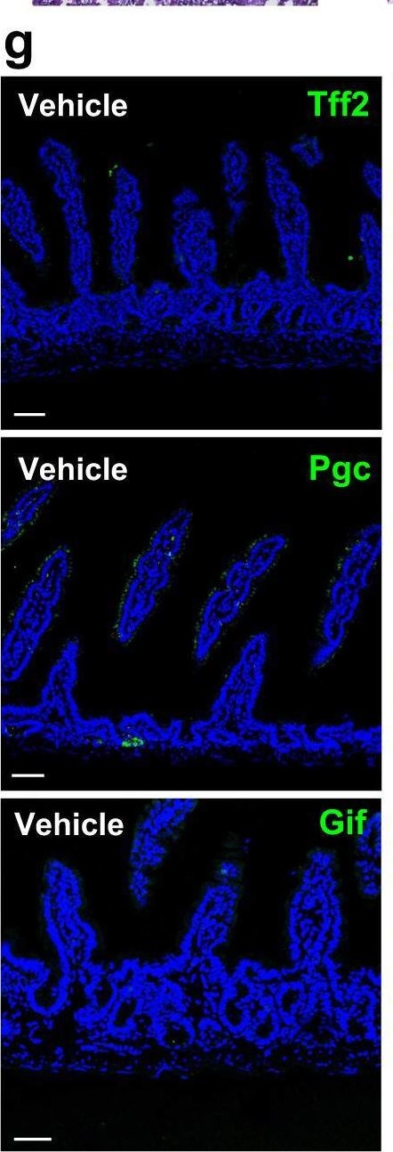 Fig.7.G showing Immunohistochemistry-immunofluorescence in a Mus musculus (House mouse) sample from the publication: Spatiotemporal reprogramming of differentiated cells underlies regeneration and neoplasia in the intestinal epithelium.