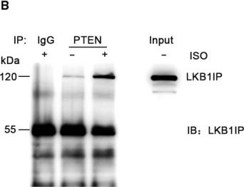 Fig.7.B showing Western Blotting in a Mus musculus (House mouse) sample from the publication: LKB1IP promotes pathological cardiac hypertrophy by targeting PTEN/Akt signalling pathway.
