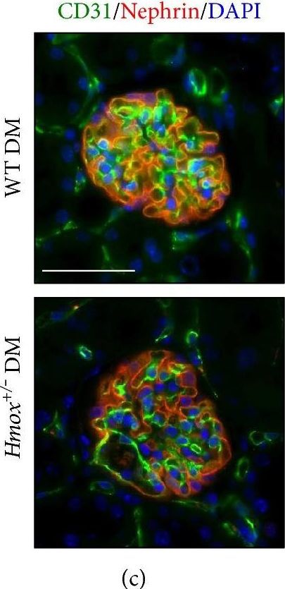 Hmox1 Deficiency Sensitizes Mice to Peroxynitrite Formation and Diabetic Glomerular Microvascular Injuries.