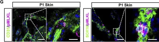 Fig.1.G showing Immunohistochemistry-immunofluorescence in a Mus musculus (House mouse) sample from the publication: Evidence for developmental vascular-associated necroptosis and its contribution to venous-lymphatic endothelial differentiation.