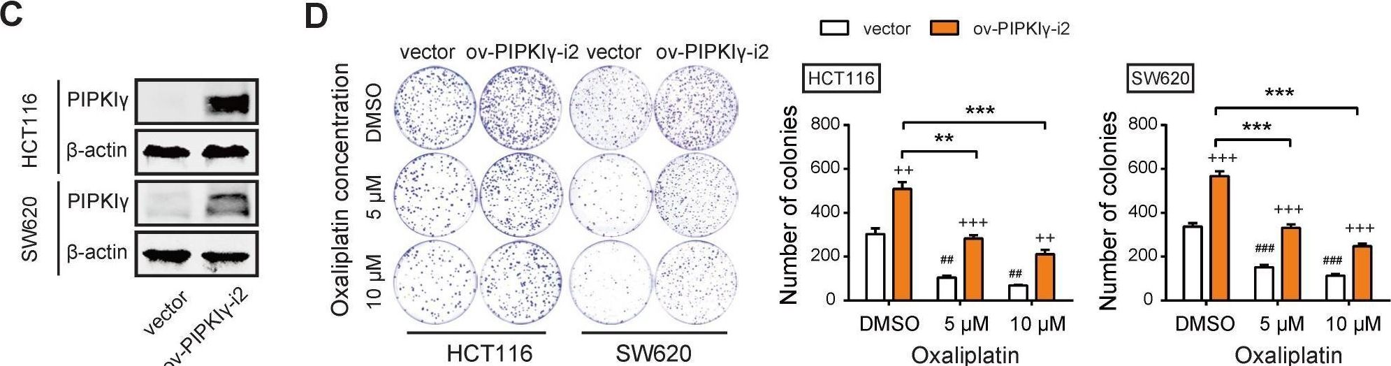 Fig.1.C showing Immunohistochemistry in a Homo sapiens (Human) sample from the publication: Targeting type Iγ phosphatidylinositol phosphate kinase overcomes oxaliplatin resistance in colorectal cancer.