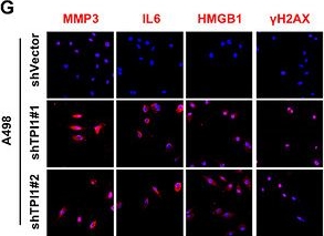Fig.3.G showing Immunocytochemistry-immunofluorescence from the publication: TPI1 Loss Triggers a Metabolite-Driven Mitochondrial Redox Vulnerability via the SARM1-cADPR-Ca2+ Axis.