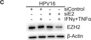 Fig.4.C showing Western Blotting from the publication: Human Papillomavirus Downregulates the Expression of IFITM1 and RIPK3 to Escape from IFNγ- and TNFα-Mediated Antiproliferative Effects and Necroptosis.