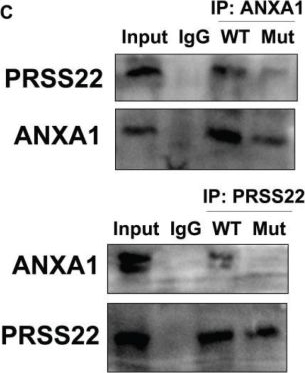 Fig.9.C showing Western Blotting from the publication: PRSS22 promotes the immune evasion of gastric cancer via inhibiting ANXA1-mediated degradation of PD-1.