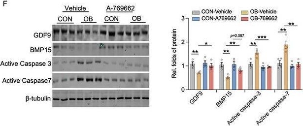 Fig.6.F showing Western Blotting from the publication: AMPK Suppression Due to Obesity Drives Oocyte mtDNA Heteroplasmy via ATF5-POLG Axis.