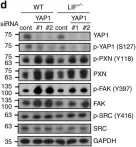 Fig.6.D showing Western Blotting in a Homo sapiens (Human) sample from the publication: Cytoplasmic LIF reprograms invasive mode to enhance NPC dissemination through modulating YAP1-FAK/PXN signaling.