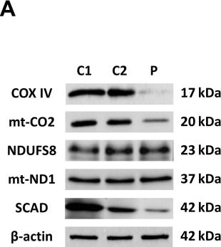 Fig.2.A showing Western Blotting from the publication: Mitochondrial Unfolded Protein Response (mtUPR) Activation Improves Pathological Alterations in Cellular Models of Ethylmalonic Encephalopathy.