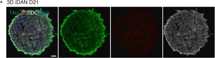 Fig.4.A showing Immunohistochemistry-immunofluorescence in a Homo sapiens (Human) sample from the publication: Protocol for 3D direct reprogramming of human glia into dopaminergic neurons with gene expression and immunocytochemistry validation.
