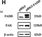 Fig.2.H showing Western Blotting from the publication: MiR-7a is an important mediator in Fas-associated protein with death domain (FADD)-regulated expression of focal adhesion kinase (FAK).