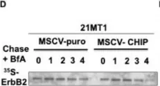 Fig.2.D showing Western Blotting in a Homo sapiens (Human) sample from the publication: CHIP/STUB1 Ubiquitin Ligase Functions as a Negative Regulator of ErbB2 by Promoting Its Early Post-Biosynthesis Degradation.