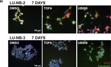 Fig.1.H showing Immunocytochemistry-immunofluorescence from the publication: Inhibition of fatty acid synthesis induces differentiation and reduces tumor burden in childhood neuroblastoma.