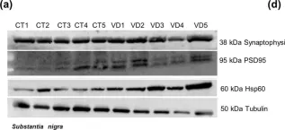 Fig.15.A showing Western Blotting from the publication: Differential protein expression in diverse brain areas of Parkinson's and Alzheimer's disease patients.