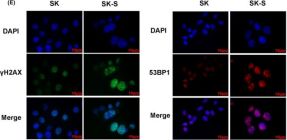 53BP1 Antibody (E7N5D) | Cell Signaling Technology
