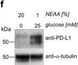 Fig.6.F showing Western Blotting in a Mus musculus (House mouse) sample from the publication: Colorectal Cancer Progression Is Potently Reduced by a Glucose-Free, High-Protein Diet: Comparison to Anti-EGFR Therapy.