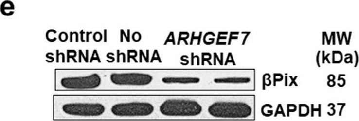 Fig.5.E showing Western Blotting from the publication: Muscarinic receptor agonist-induced βPix binding to β-catenin promotes colon neoplasia.