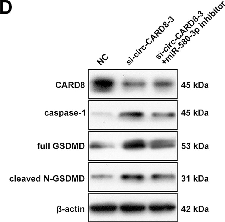 Fig.8.D showing Western Blotting in a Homo sapiens (Human) sample from the publication: Circular RNA circ-CARD8 regulates alveolar macrophage pyroptosis through the miR-580-3p/CARD8 pathway in acute lung injury.