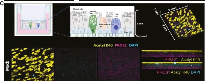 Fig.2.C showing Immunohistochemistry-immunofluorescence in a SARS-CoV-2 sample from the publication: PROS1 released by lung basal cells limits inflammation in epithelial and monocytes during SARS-CoV-2 infection.