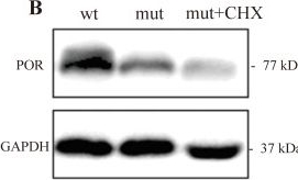 Fig.3.B showing Western Blotting from the publication: Functional and structural characterization of POR splicing variants reveals pathogenic mechanisms in PORD.