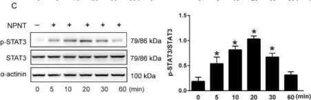 Phospho-Stat3 (Tyr705) (D3A7) Rabbit Monoclonal Antibody
