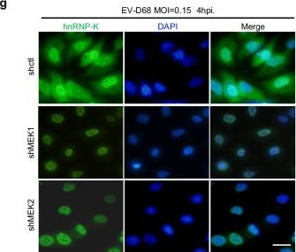 Fig.5.G showing Immunocytochemistry-immunofluorescence from the publication: The CXCL8/MAPK/hnRNP-K axis enables susceptibility to infection by EV-D68, rhinovirus, and influenza virus in vitro.