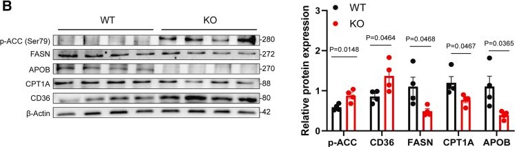 Fig.6.B showing Western Blotting in a Mus musculus (House mouse) sample from the publication: Systematic profiling reveals hepatic immune and metabolic dysregulation in DNASE1L3-deficient mice.