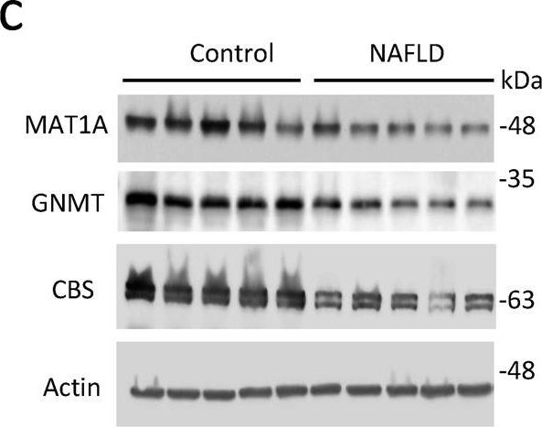 Fig.7.C showing Western Blotting from the publication: TFEB regulates sulfur amino acid and coenzyme A metabolism to support hepatic metabolic adaptation and redox homeostasis.