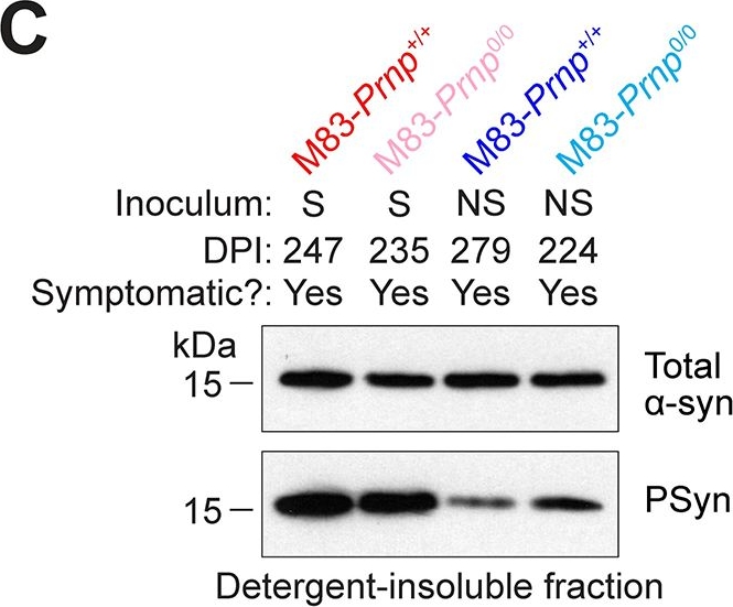 Fig.6.C showing Western Blotting in a Mus musculus (House mouse) sample from the publication: α-Synuclein strain propagation is independent of cellular prion protein expression in a transgenic synucleinopathy mouse model.