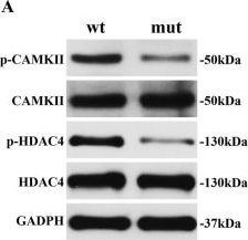Fig.4.A showing Western Blotting from the publication: TPM1-p.E181K mutation suppresses CaMKII/HDAC4 signaling pathway leading to pediatric restrictive cardiomyopathy.