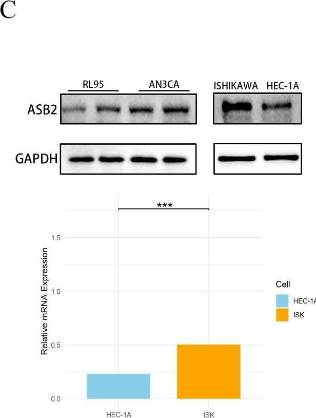 Fig.9.C showing Western Blotting in a Homo sapiens (Human) sample from the publication: CD8+ T cell activation in endometrial cancer: prognostic implications and potential for personalized therapy.