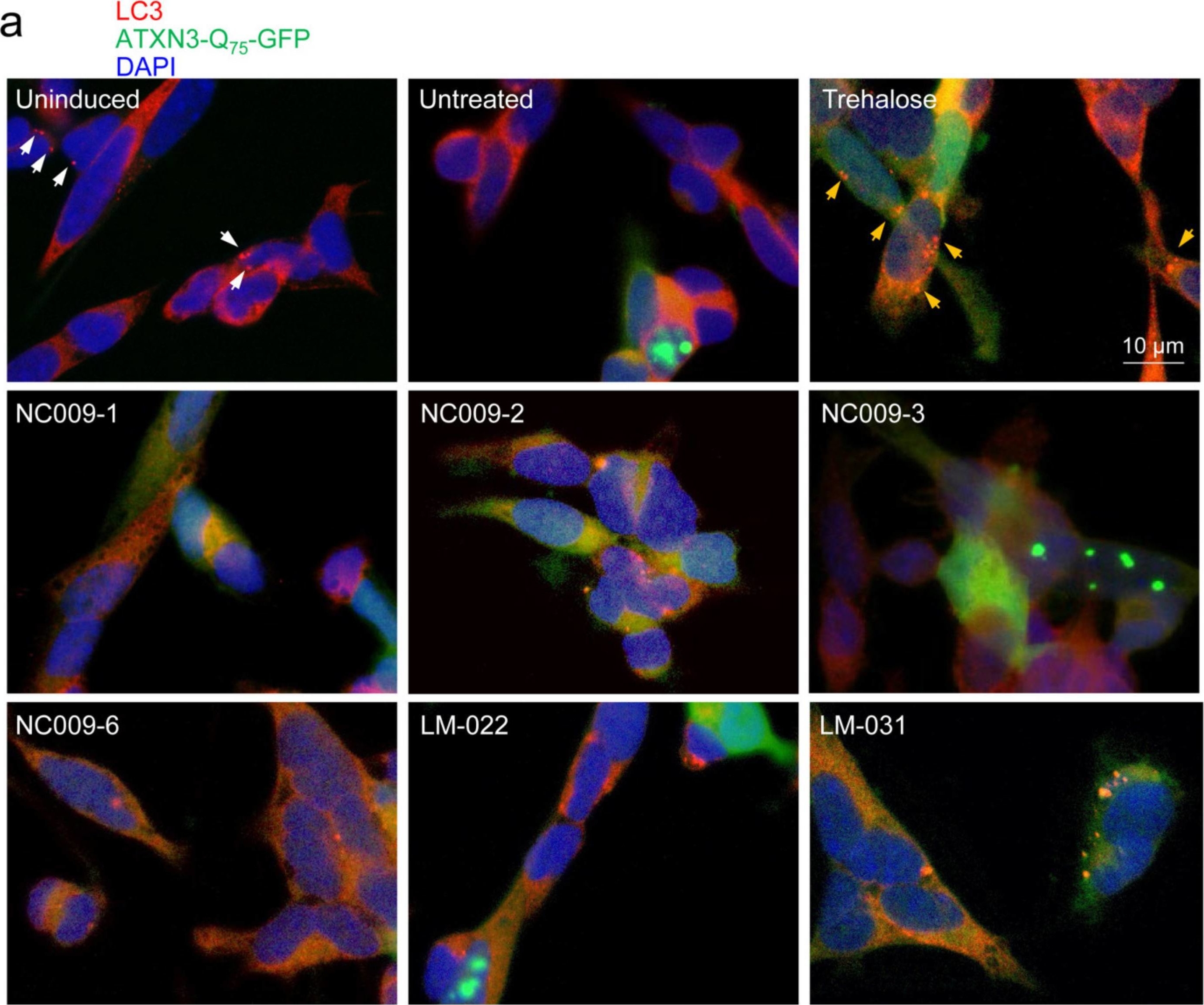 Fig.4.A showing Immunocytochemistry-immunofluorescence in a Homo sapiens (Human) sample from the publication: Small Molecules Inducing Autophagic Degradation of Expanded Polyglutamine Protein through Interaction with Both Mutant ATXN3 and LC3.